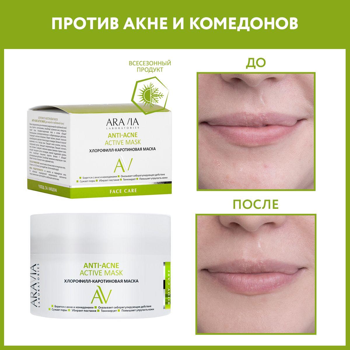 ARAVIA Laboratories | ARAVIA Laboratories Хлорофилл-каротиновая маска ANTI-ACNE ACTIVE MASK, 150 мл