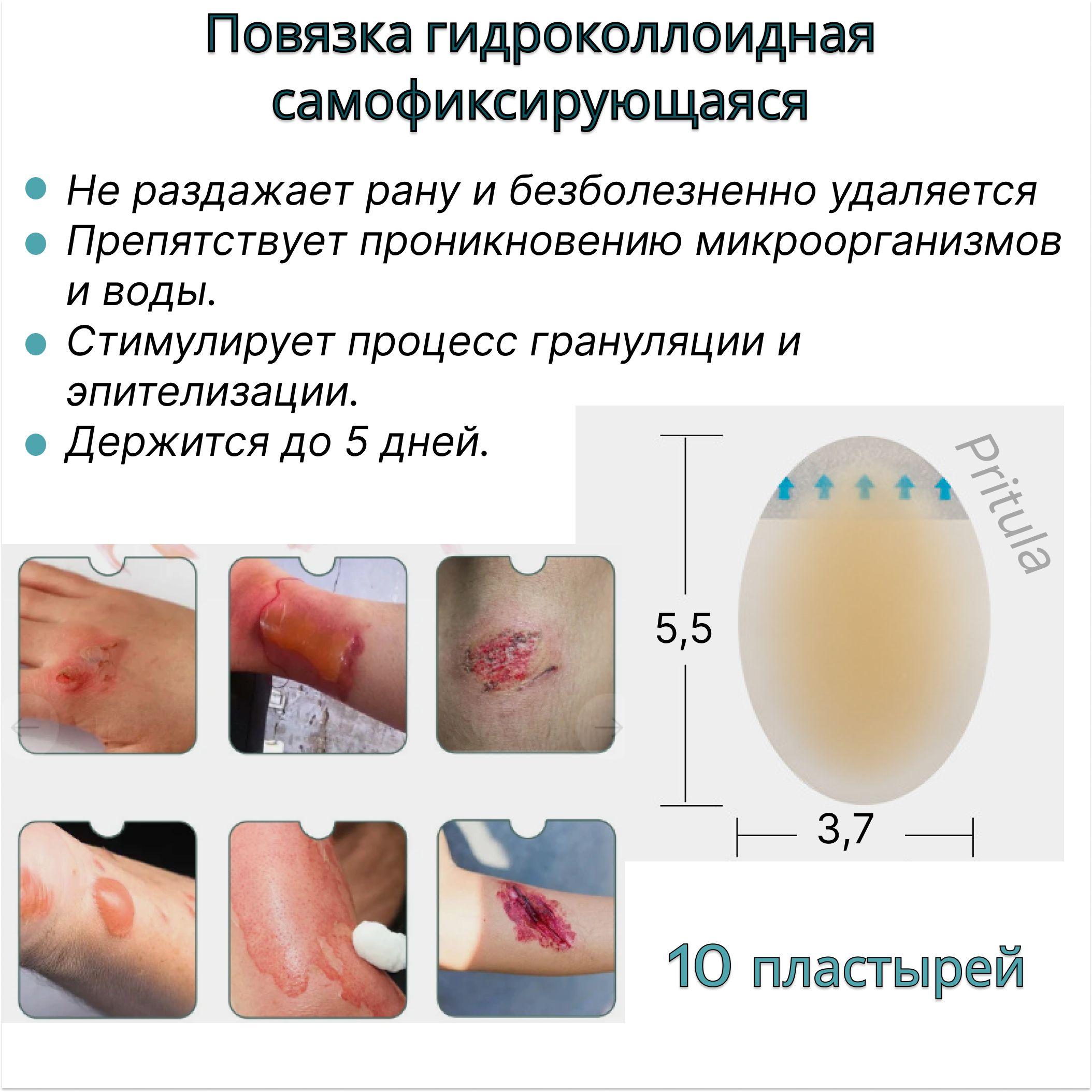 Повязка на рану гидроколлоидная обезболивающая от пролежней10 штук