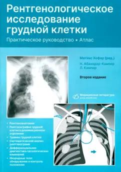 Матиас Хофер: Рентгенологическое исследование грудной клетки. Практическое руководство. Атлас